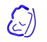 Engine Hoses Compatible with Jeep for Cherokee XJ 4.0L 6 Cylinder 1991-1995 1996 1997 1998 1999 2000 2001 Radiator Coolant Hose Upper Lower Pipe(Blue,Size 6pcs)