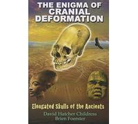 Enigma Of Cranial Deformation: Elongated Skulls of the Ancients
