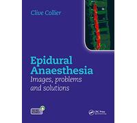 Epidural Anaesthesia: Images, Problems and Solutions