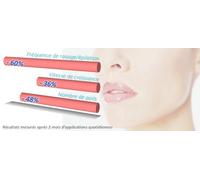 Epil Xpress Hair Reduction Lotion for the Face