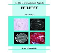 Epilepsy (Atlas of Investigation and Management)