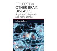 Epilepsy in Other Brain Diseases – A Guide to Diagnosis and Management
