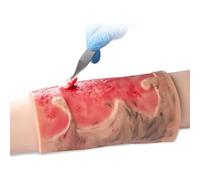 ERICAT Simulated Burn Wound Model, 2-3 Degree Wound Care Wound Models, Realistic Appearance Design and Rapidly Improve Skills, Wearable Design and Reusabilit Use, for Teaching and Learning