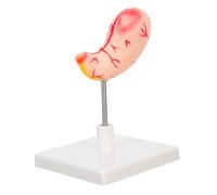 ERINGOGO High Precision Human Stomach Anatomy Model for Medical Education Detailed Stomach Organ Teaching Tool with Easy Assembly for Science Classrooms and Clinical Training
