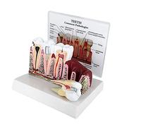 ERNZI Oral Teaching Model For Teeth, Anatomical Model With Removable Tooth, Teeth With Common Pathologies, Dental Pathology Display For Education, Patient Communication