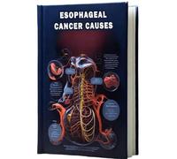 Esophageal Cancer Causes: Understand the causes and risk factors associated with esophageal cancer, a malignancy that affects the esophagus.