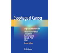 Esophageal Cancer: Diagnosis and Treatment