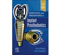Essentials and Innovations in Implant Prosthodontics