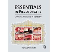 Essentials in Peiezosurgery: Clinical Advantages in Dentistry