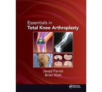 Essentials in Total Knee Arthroplasty