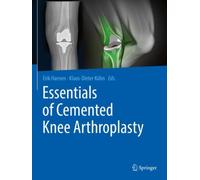 Essentials of Cemented Knee Arthroplasty