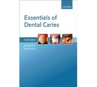 Essentials of Dental Caries