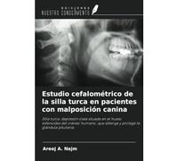 Estudio cefalométrico de la silla turca en pacientes con malposición canina: Silla turca: depresión ósea situada en el hueso esfenoides del cráneo humano, que alberga y protege la glándula pituitaria.