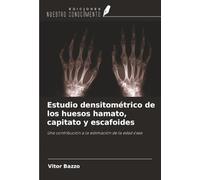 Estudio densitométrico de los huesos hamato, capitato y escafoides: Una contribución a la estimación de la edad ósea