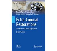 Extra-Coronal Restorations: Concepts and Clinical Application (BDJ Clinician’s Guides)