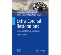 Extra-Coronal Restorations: Concepts and Clinical Application (BDJ Clinician’s Guides)
