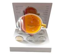 Eye Anatomy Model Realistic Pathological Model for Research Educational Use and Clinical Demonstration Anatomy