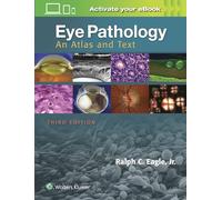 Eye Pathology: An Atlas and Text