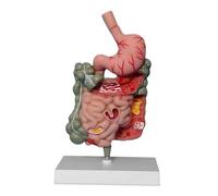 F Fityle Human Digestive System Model,Stomach Section PVC Sturdy Scientific Rectum Duodenum Model Classroom Display for Demonstration