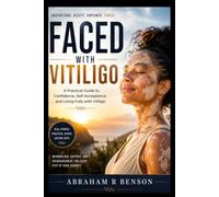 Faced with vitiligo: A Practical Guide to Confidence, Self-Acceptance, and Living Fully with Vitiligo