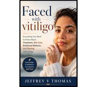Faced with vitiligo: Everything You Need to Know About Treatment, Skin Care, Emotional Wellness, and Thriving with Vitiligo