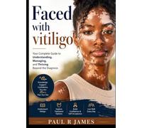 Faced with vitiligo: Your Complete Guide to Understanding, Managing, and Thriving Beyond the Diagnosis