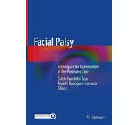 Facial Palsy: Techniques for Reanimation of the Paralyzed Face