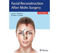 Facial Reconstruction After Mohs Surgery – Thieme