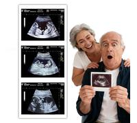 Fake Pregnancy Positive Ultrasound Personalized Prank Ultrasound for Practical Joke Pranks Funny Sonogram Reports Gag Gift & Joke Item for Adults, Gag Props，Novelty items (Twin 12 weeks)