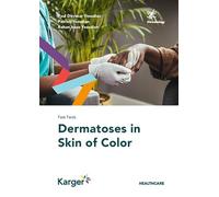 Fast Facts: Dermatoses in Skin of Color