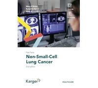 Fast Facts: Non-Small-Cell Lung Cancer