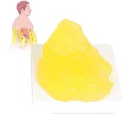 Fat Anatomical Model, 1 Lb Human Body Fat Replica with Base, Human Fatty Tissue Demonstration Model for Medical Student