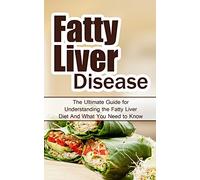 Fatty Liver Disease: The Ultimate Guide for Understanding the Fatty Liver Diet And What You Need to Know (FLD, Alcohol, NAFLD, Metabolic Syndrome, Steatosis, Alcoholic Liver Disease, Obesity)