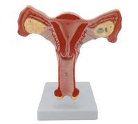Female Genital and Ovary Model Anatomical Internal Reproductive Organs Teaching Tool for Clinical Settings Ovarian Anatomy
