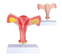 Female Ovary Model, Human Organ Anatomy Model, Human Female Genital Organ for Medical Science Education Study or Teaching