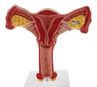 Female Ovary Model - Life Size Human Uterus and Ovary Model Female Reproductive Organ Model for Studying and Communication