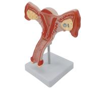 Female Pelvic Anatomy Model Classroom Teaching Tool Anatomical Female Genital and Ovary Model for Demonstrations Lecture Gynecological Training