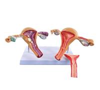 Female Reproductive Organ Model with Display Base for School Teaching Demonstration