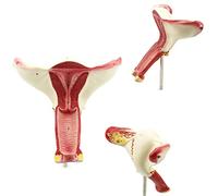 Female Reproductive System Anatomical Model,1.5X Uterus Anatomical Model,Female Anatomy Vagina Uterus Anatomy Lab Supp
