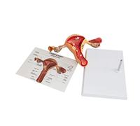 Female reproductive system anatomical model uterine pathology model uterine lesion uterine model ovarian lesions uterine