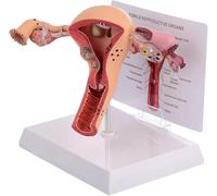 Female Reproductive System Human Uterus Model 3D Uterus and Ovary Model, Female Reproductive System, for Teaching and Learning, Display Tool Anatomical Model