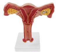 Female Uterus and Ovary Anatomical Model,Human Female Genital Organ for Medical Science Education Study or Teaching