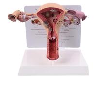Female Uterus Ovary Model, Detailed Ovary Pathology Model, Human Female Genital Organ for Medical Science Education Study or Teaching