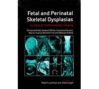 Fetal and Perinatal Skeletal Dysplasias: an Atlas of Multimodality Imaging