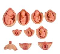 Fetal Embryo Development Model, Medical Anatomical Pregnancy Embryo Development Model, Teaching Equipment for Medical Education Study, for Education Study, Uterine Anatomy