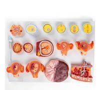 FHSLKXIM Embryo Development Model Human Fertilization And Early Embryonic Development Process 16 Parts Anatomy Model for Medical Teaching Demonstration Tool