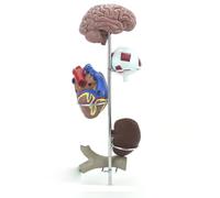 FHSLKXIM Pathological Model of Human Hypertension 5 Parts Brain Eye Heart Kidney Blood Vessel PVC Life-Size Human Kidney Organ Anatomy Model Educational