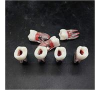 FHUILI Teeth Model for Educational - Root Canal Filling Model in Vitro Tooth with Root Red Pulp Cavity - Dental Teeth Study Teaching Model - Simulation Oral Tooth Dentist Exam Practice Tooth,A