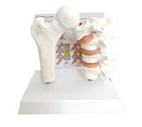 FHUILIJH Anatomical Osteoporosis Femur Model - Human Anatomy Osteoporosis Model - for Medical Student Teaching Demonstration,Flesh,20cm