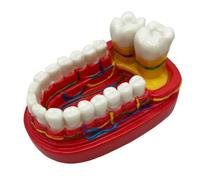 FHUILIJH Six Times Larger Molar Nerve Molar Model - Teeth Teaching Model - for Dental Medicine Teaching Aids,Flesh,10cm